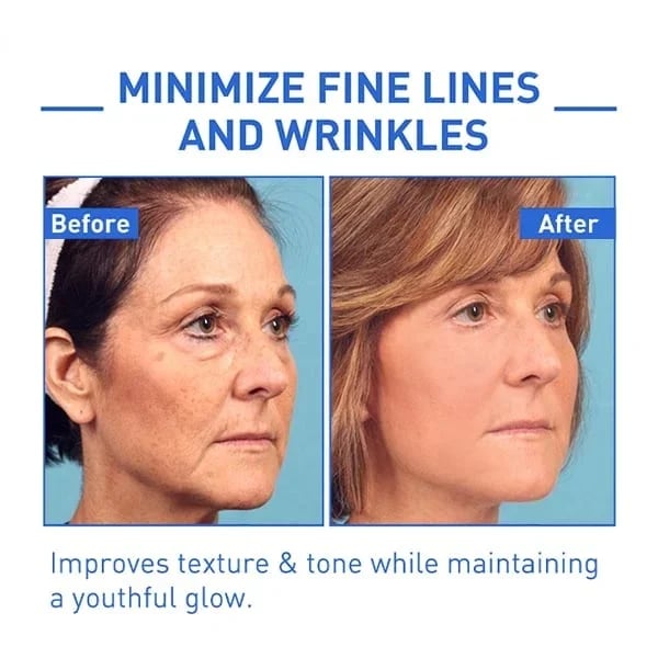 【 Official Brand store】Instant Wrinkle Eye Tightener cream (✨Buy 3 Get 1 Free💕)